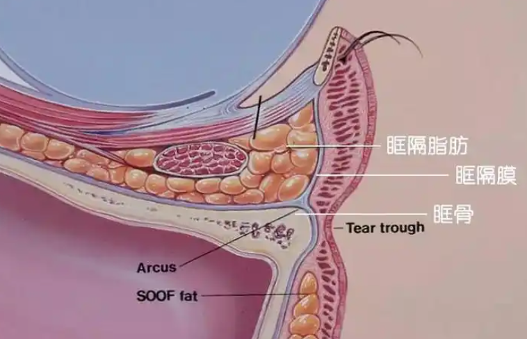 去眼袋手术