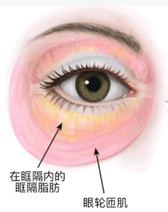 去眼袋手术
