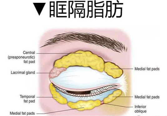 去眼袋手术