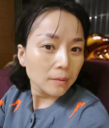 去眼袋手术