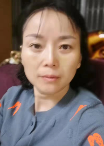 去眼袋手术
