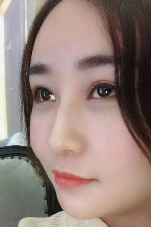 去眼袋手术