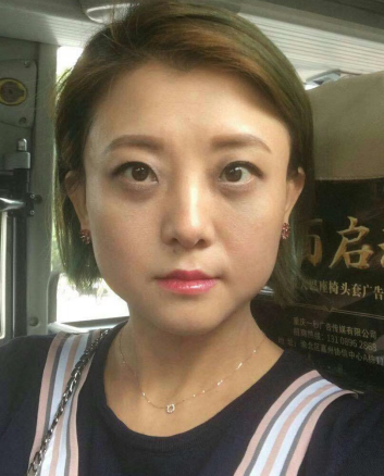 去眼袋手术