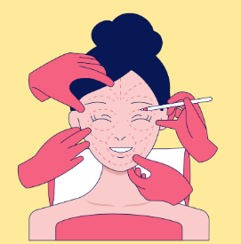 去眼袋手术