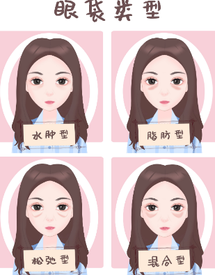 去眼袋手术