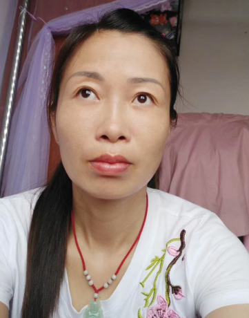 去眼袋手术