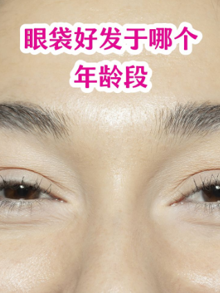 去眼袋手术