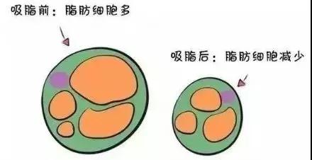 吸脂减肥：人间芭比Lisa在国内照妖镜下，真实颜286