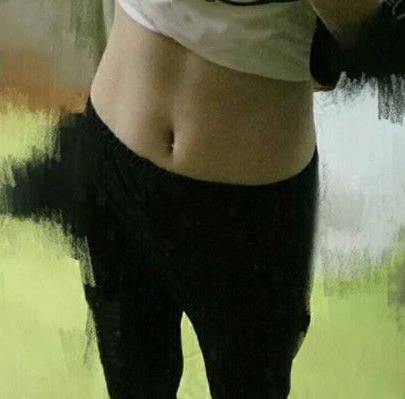 超声波减肥