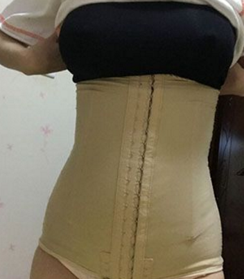 超声波减肥