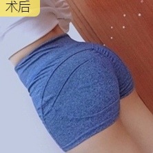 超声波减肥