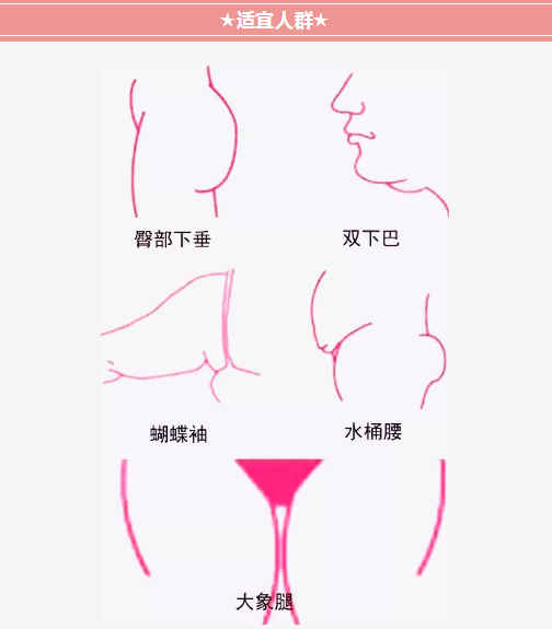 重庆超雅超声波吸脂减肥,让你冬天穿衣不发愁626 重庆超雅超声波吸脂减肥,让你冬天穿衣不发愁626