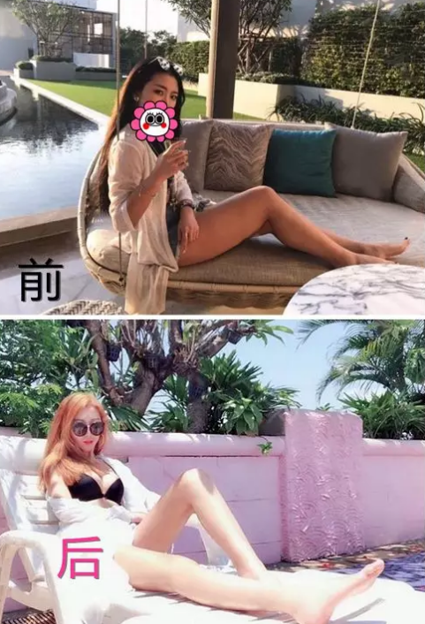 超声波减肥