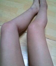 吸脂减肥