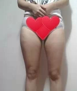 超声波减肥