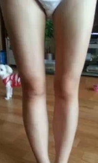 超声波减肥