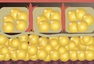 超声波减肥