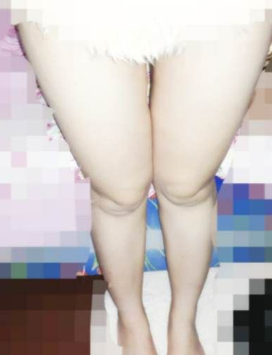 超声波减肥