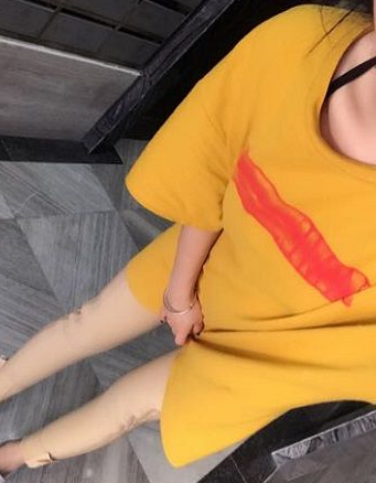 超声波减肥
