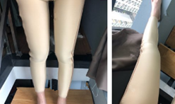 超声波减肥