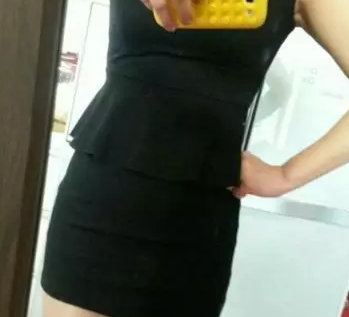 超声波减肥