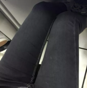 超声波减肥