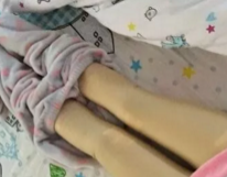 超声波减肥