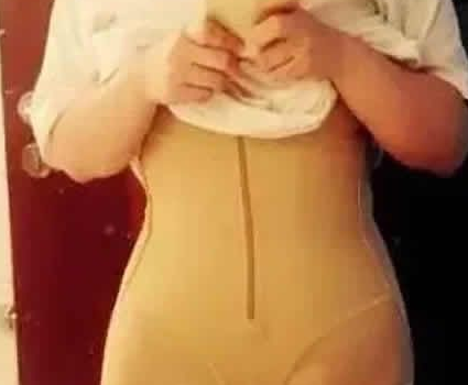 超声波减肥