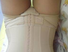 超声波减肥