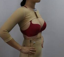 超声波减肥