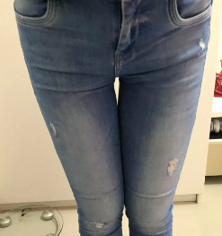 超声波减肥