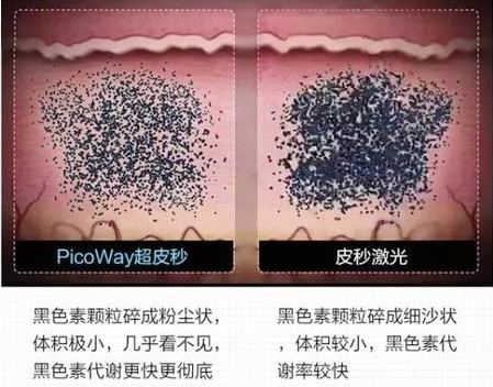 祛斑的费用高不高?要做几次?885 祛斑的费用高不高?要做几次?885